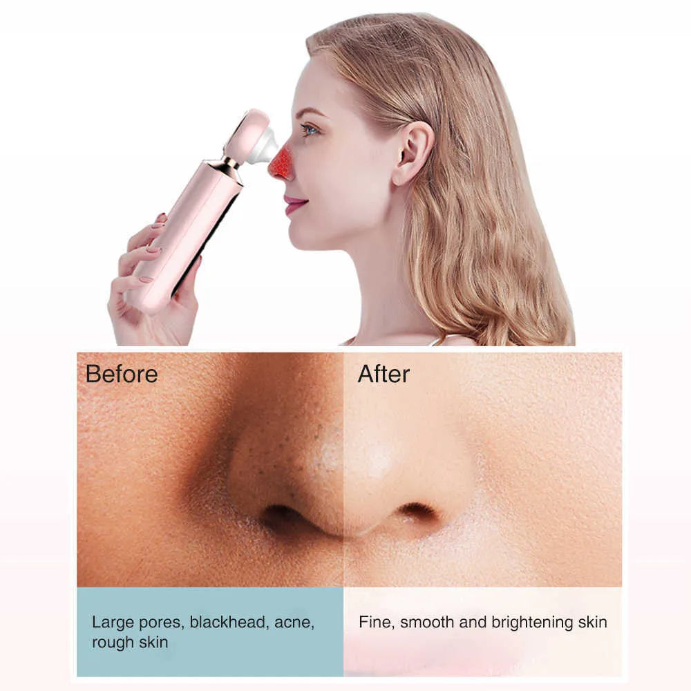 NoorElla™ Blackhead Suction Machine